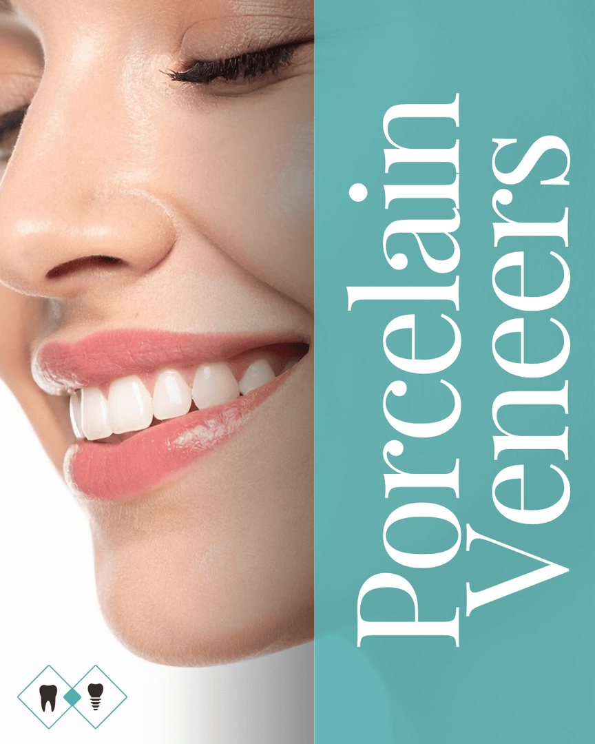 CornerstoneDMD's tweet photo. Porcelain veneers are ultra-thin, custom-crafted ceramic shells designed to cover chips, stains, gaps, and uneven teeth, creating a brighter, more balanced smile that still looks completely natural. 🙌 https://t.co/x9DQvQEaY7 https://t.co/1Mzuqb00Kk