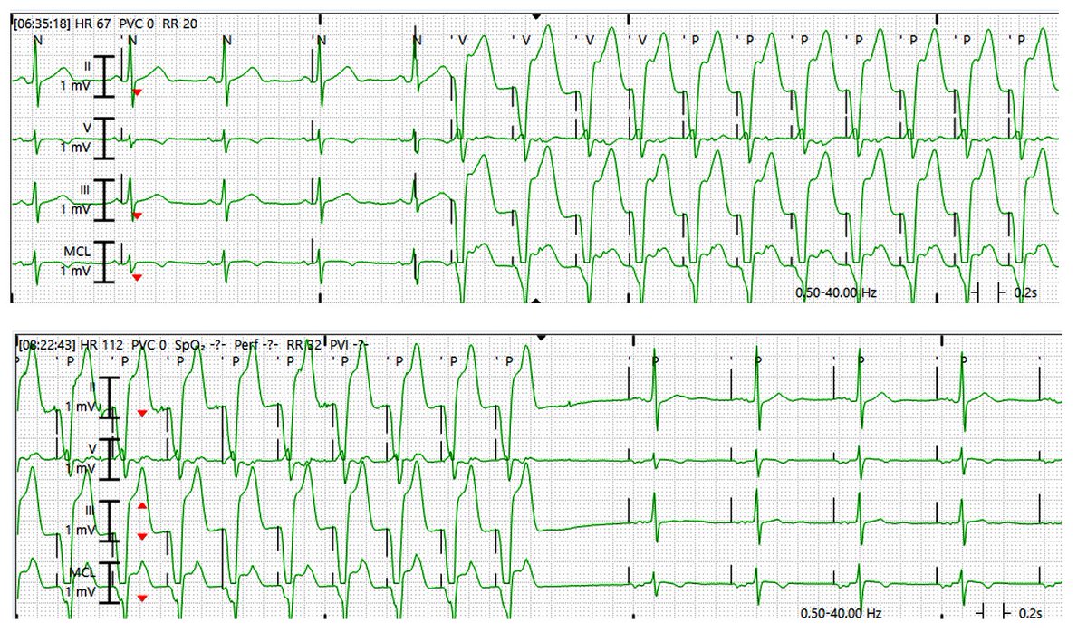 Ashkan Ehdaie MD tweet media