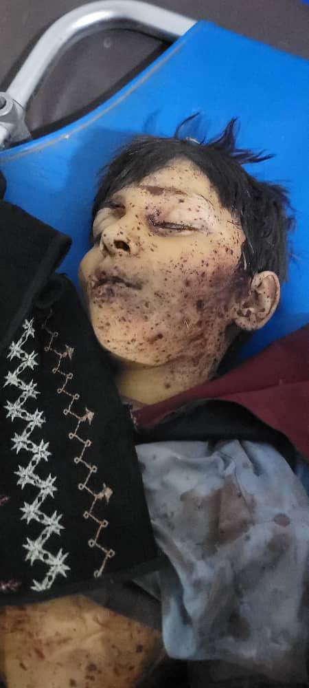 #BREAKING: Pakistan Army Chief Asim Munir orders killing of Afghan Muslim civilians and children to seek revenge from Taliban. 

Statement by Office of the Spokesman, Kabul,  Islamic Emirate of Afghanistan

The military regime of Pakistan has once again deliberately targeted the