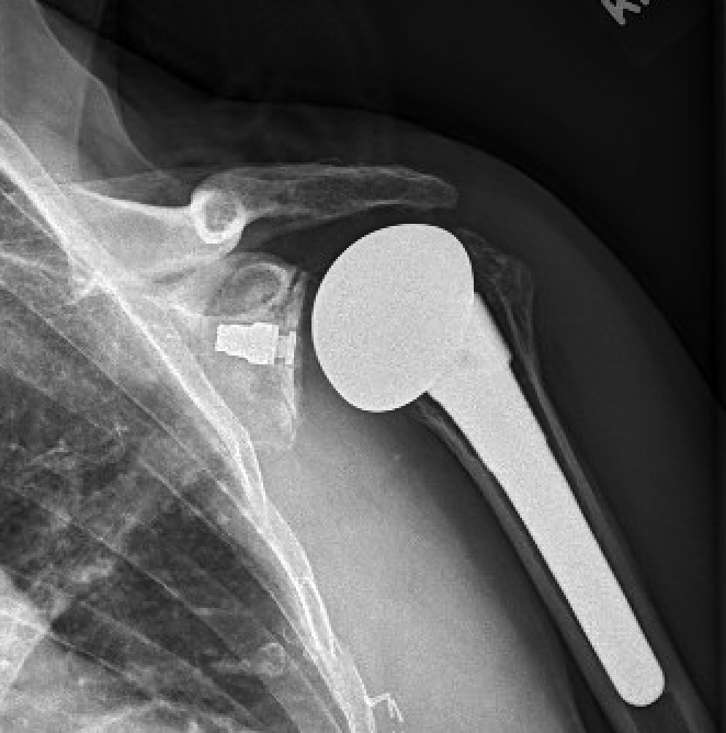 Rick Matsen tweet media