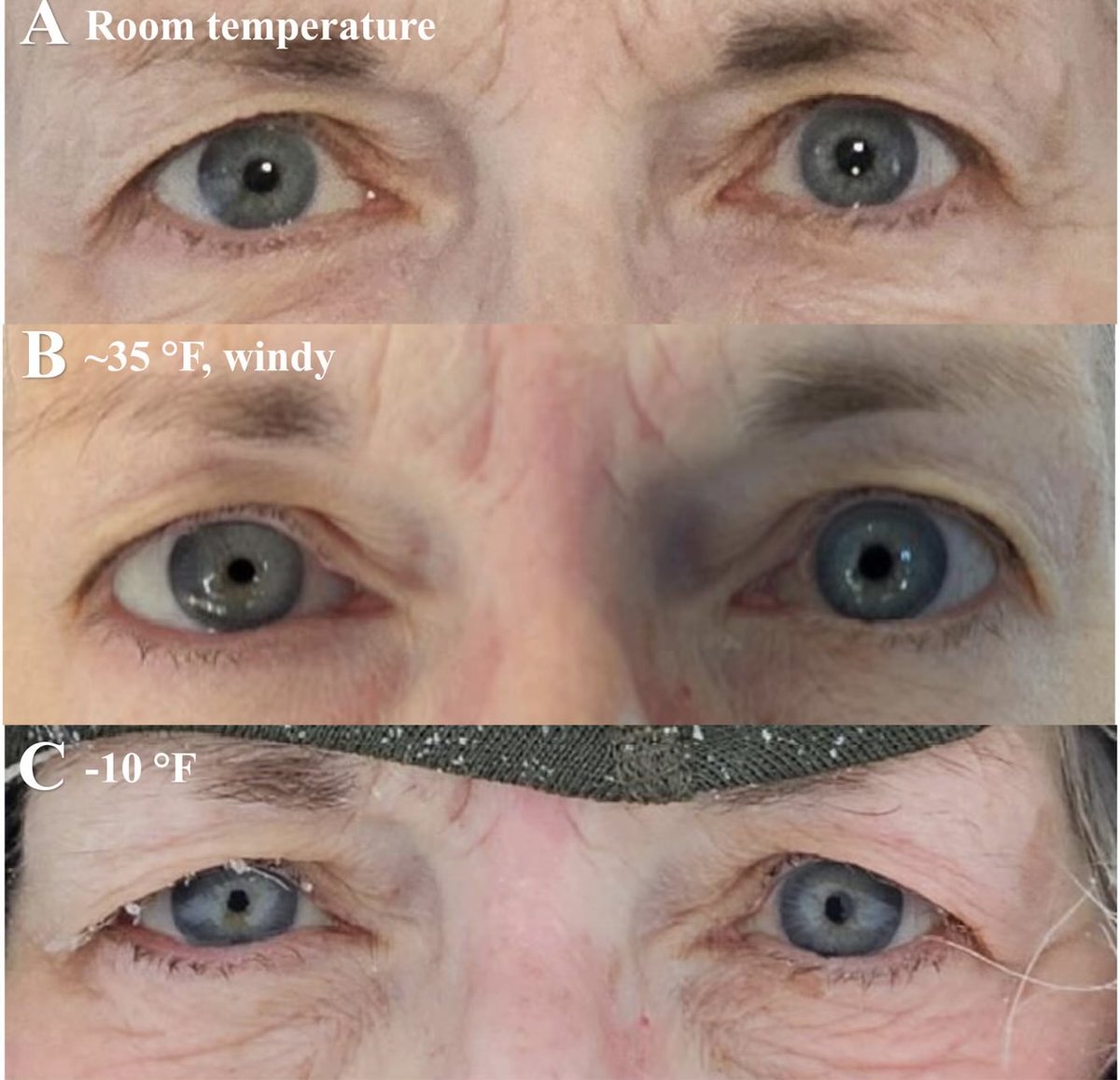 Joshua D. Palmer, MD tweet media