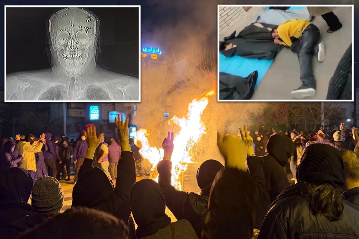 Full extent of horror within Iranian hospitals revealed after regime's brutal crackdown on protesters trib.al/HijKG5X