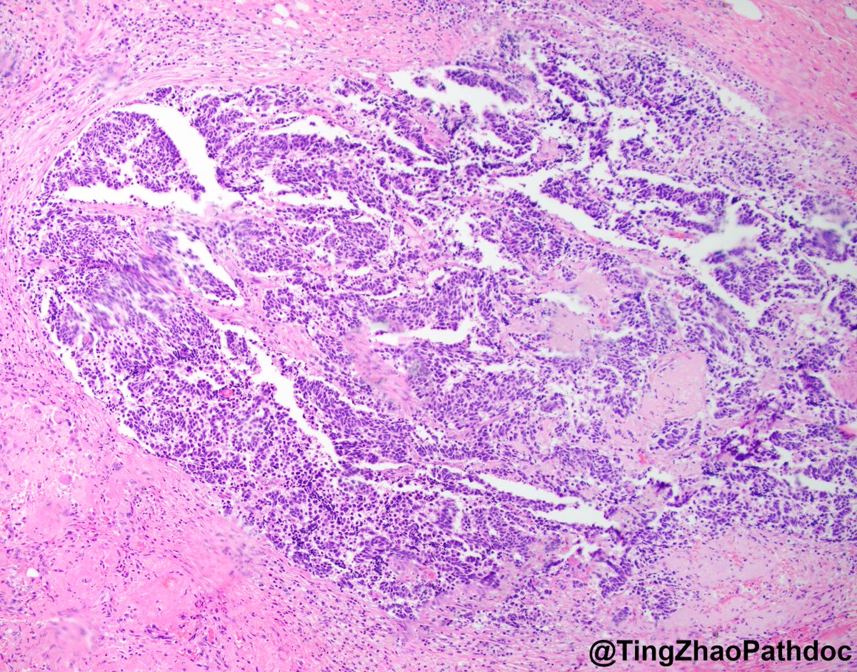 Ting Zhao, MD tweet media