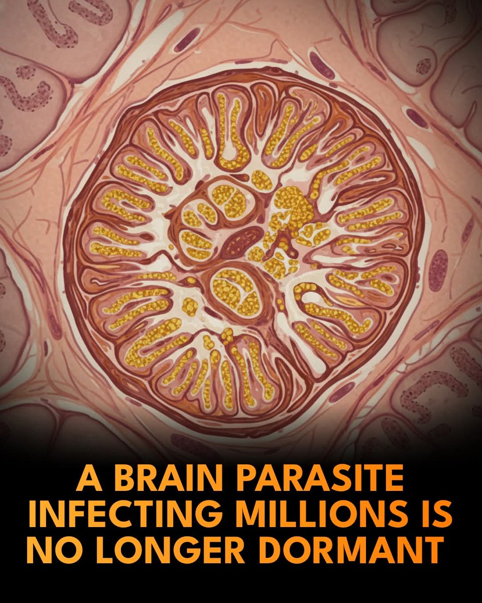 🚨 A “dormant” brain parasite may be secretly active in millions of people

A common brain parasite that infects more than a third of the global population may be far more active than scientists once believed. Toxoplasma gondii, which reproduces in cats and often infects humans
