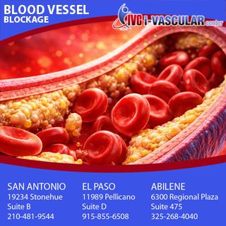 ivascularAB's tweet photo. You brush your teeth to prevent plaque. But did you know that your blood vessels have their own type of plaque buildup? Vein blockage can impact your health, from simple numbness to heart attacks or stroke. If you experience swelling or redness, contact https://t.co/btxiwXdf6Z https://t.co/gYv1Rac4kp