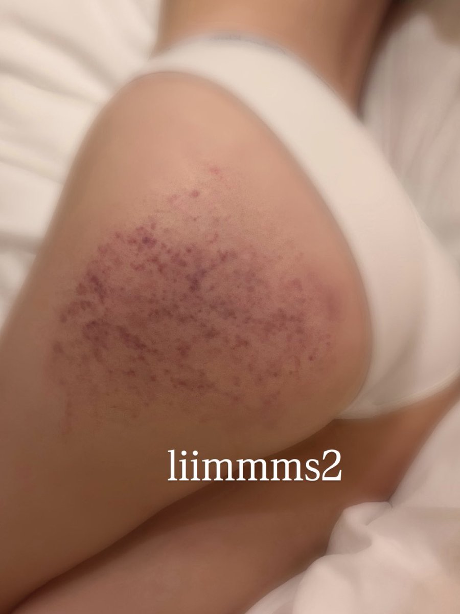 liimmms2's tweet photo. 맞는거 좋아 ㅎㅎㅠㅠ https://t.co/dYwjpfdPXO