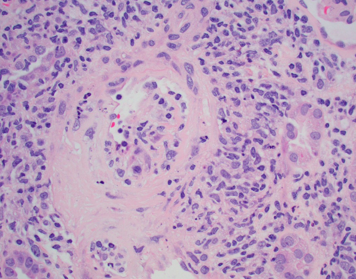 Jonathan Zuckerman MD PhD tweet media