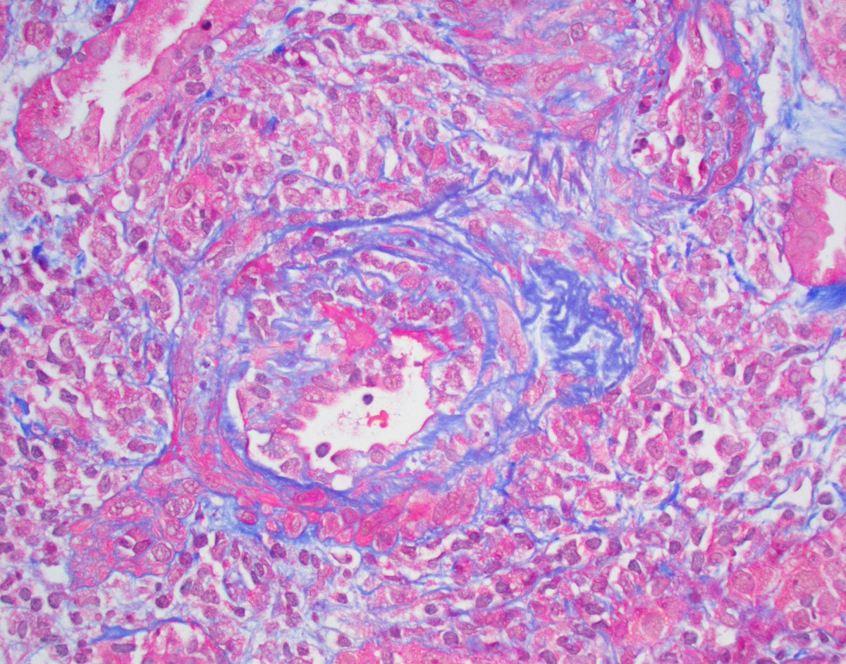 Jonathan Zuckerman MD PhD tweet media