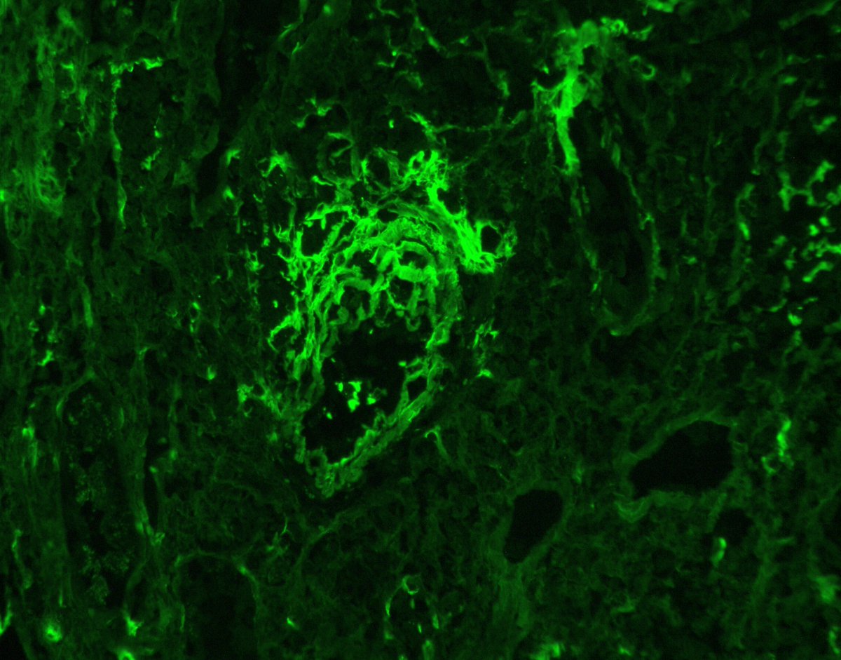 Jonathan Zuckerman MD PhD tweet media