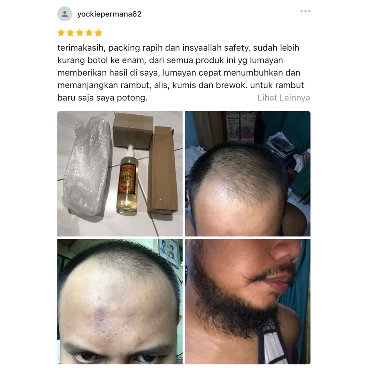 0tk0il's tweet photo. HAIR TONIC  THRANDUAL

Kemasan :
100ml ( 105K )
250ml ( 245K )

pesan via wa : 081931283259

- meningkatkan pertumbuhan rambut
- mencegah rambut rontok
- melembabkan kulit kepala
- memperbaiki rambut rusak/kering
- mengurangi uban 
- mengatasi ketombe

wajib bagi yang sering ngecat rambut yang sering pake pomade dan yang malas cuci rambut

Cara pemakaian
semprotkan produk ini ke kulit kepala dan rambut kapan saja bisa saat kering atau saat basah ( setelah keramas ) lalu pijat lembut agar meresap sempurna.