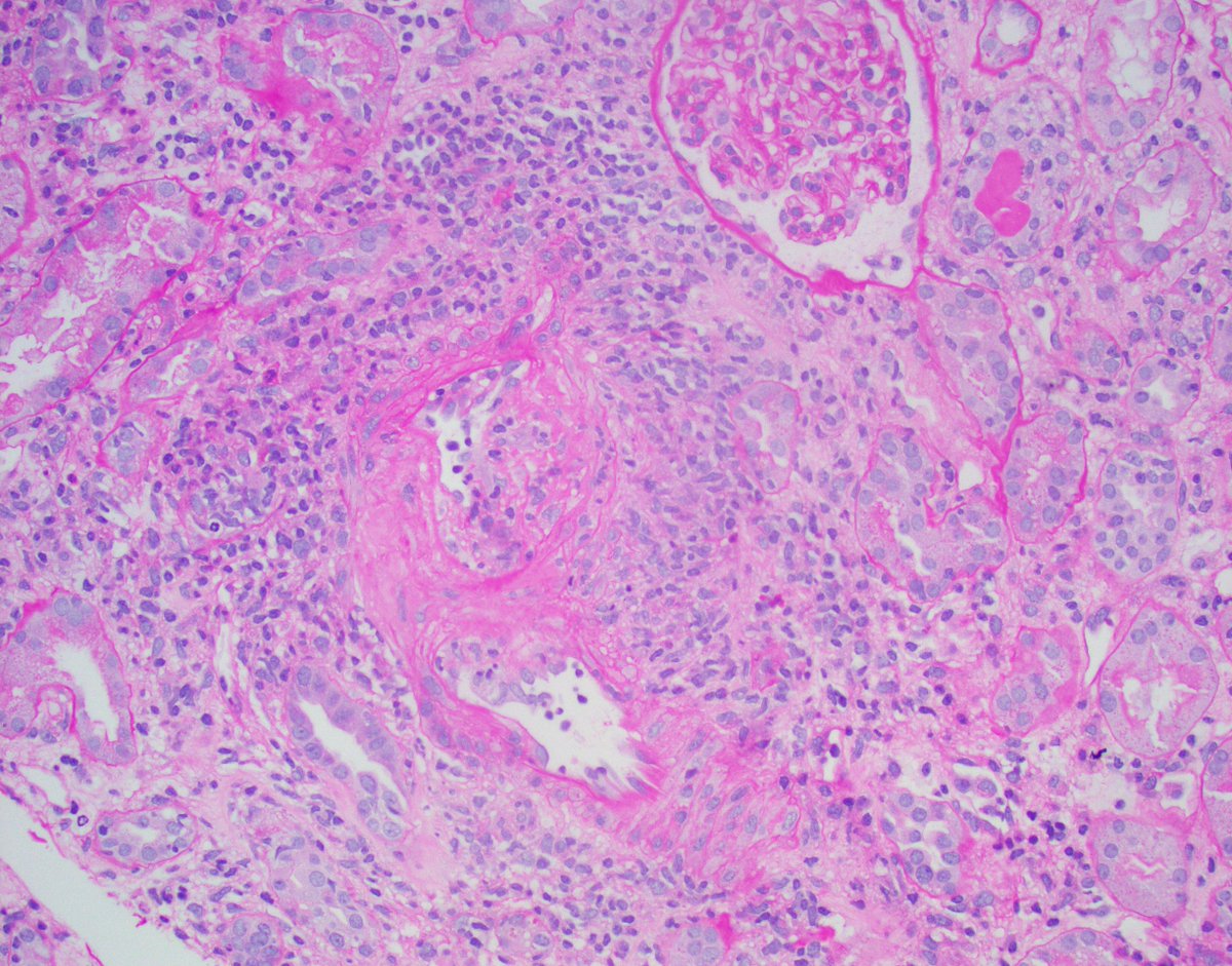 Jonathan Zuckerman MD PhD tweet media