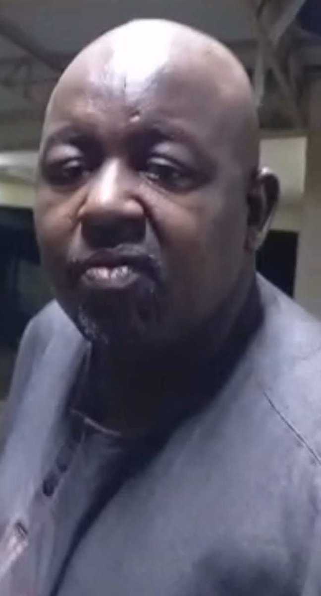 The Face of a Dare D€vil;

Ardo Lawal Mohammed. 

This is the Fulani terr0rist who master minded the genocide in Yelewata on June 13, 2025, &amp; surpritended the k!lling of children, women, aged, youth, through gunshots, gruesome slaughter, burning by fire, and the razing of houses