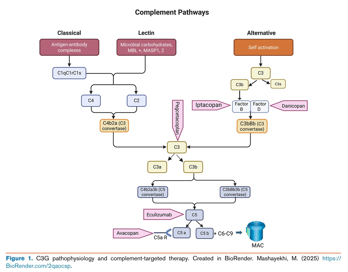edgarvlermamd's tweet photo. C3 Glomerulopathy Diagnosis, Current Treatments, and Emerging Therapies ca. 2026 from @KidneyMed @JZRenalPath @IgAN_JBarratt @GlassockJ @DrRaymondHsu @Nephronpower @rahaai @SaynaNorouzi 
#Nephpearls 

👉 https://t.co/kJE6y57ag4 https://t.co/ixs4hmVtW4