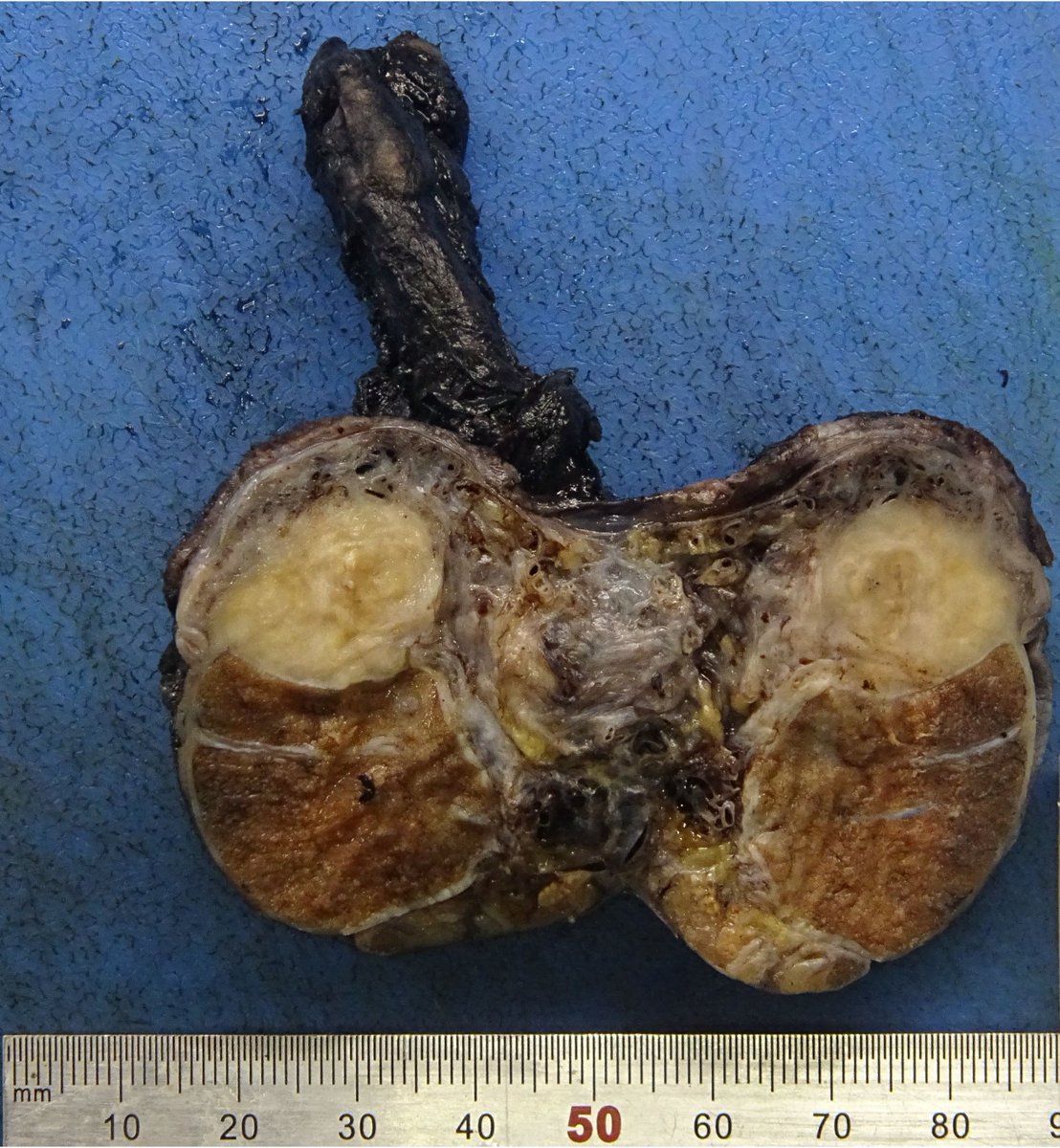 Kenny De Gracia T. tweet media