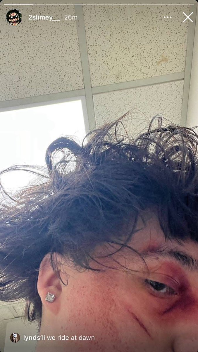 SSStral's tweet photo. 2slimey got jumped  😳 https://t.co/sySgdSYjVF