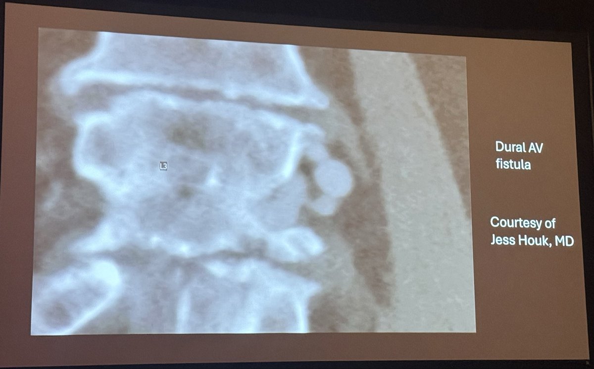 American Society of Spine Radiology (ASSR) tweet media