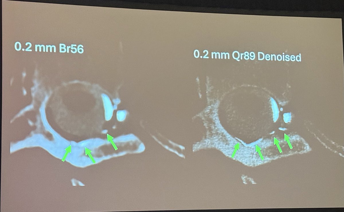 American Society of Spine Radiology (ASSR) tweet media