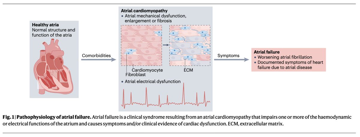 gonzaeperez's tweet photo. FALLA AURICULAR: DESDE EL DIAGNÓSTICO A LAS IMPLICANCIAS CLÍNICAS
Revisión @NatRevCardiol @adribaran 👌

🔴Falla auricular: síndrome clínico resultante de la cardiomiopatía atrial
🔴Alteraciones eléctricas y/o hemodinámicas 
🔴Se clasifican en primaria o secundaria
🔴Diagnóstico: dx de cardiomiopatia atrial + manifestaciones clínicas 
🔴Es una causa de HFpEF en la que debemos pensar
🔴Investigaciones futuras permitirán un conocer mejor sus mecanismos fisiopatológicos y opciones terapéuticas

https://t.co/MnD1PytRfr