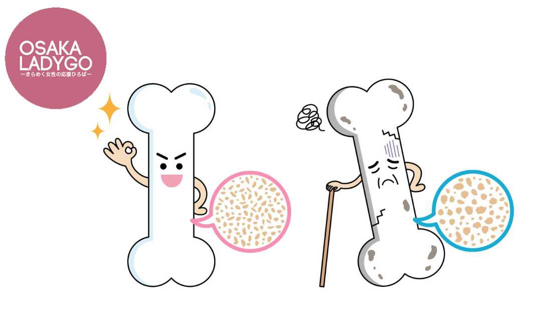 女性の健康セミナーのご案内です！

骨粗しょう症について正しく知り、骨づくりに役立つ食事や生活習慣をわかりやすく学びます。自分の骨の健康を守っていきましょう。

《第１回テーマ》骨粗しょう症を正しく知るために
《第２回テーマ》今日からできる骨の健康習慣

osakaladygo.info/osteoporosis-p…