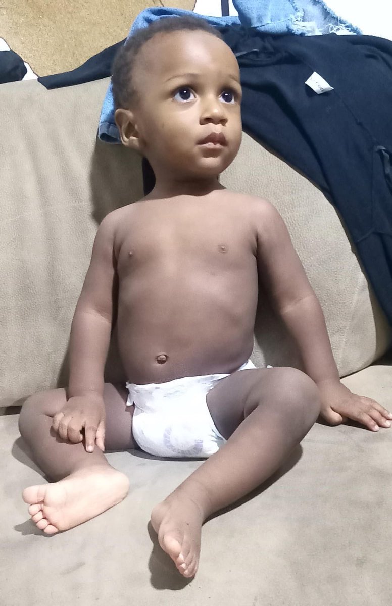 mcdc_mcdc's tweet photo. Amigos, pido #AYUDA para el más chiquito de mis niños: Samuel, 1 año.
Es hermanito de 2 pacientes crónicas, 1 oncológica. 
Aún en estudio, diagnóstico: Alta selectividad alimentaria.
Necesita
♦️Consulta donada con neurólogo pediatra
♦️Receta (foto)
♦️Pediasure
☎️0981932934 #Gye https://t.co/SIwH0FMsjh