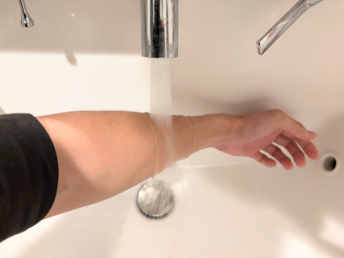 花粉症が酷い人へ。前腕に冷水をあててみて下さい。場所は前腕真ん中あたりで手の甲側。親指・人差し指と肘を結んだ線上ですね。経絡アプローチですが、このラインは多気多血で熱を生みやすい陽明経が走る所。余分な熱が邪魔をして花粉症を悪化させることがあるので、左右10秒ずつ冷水をあててクールダ