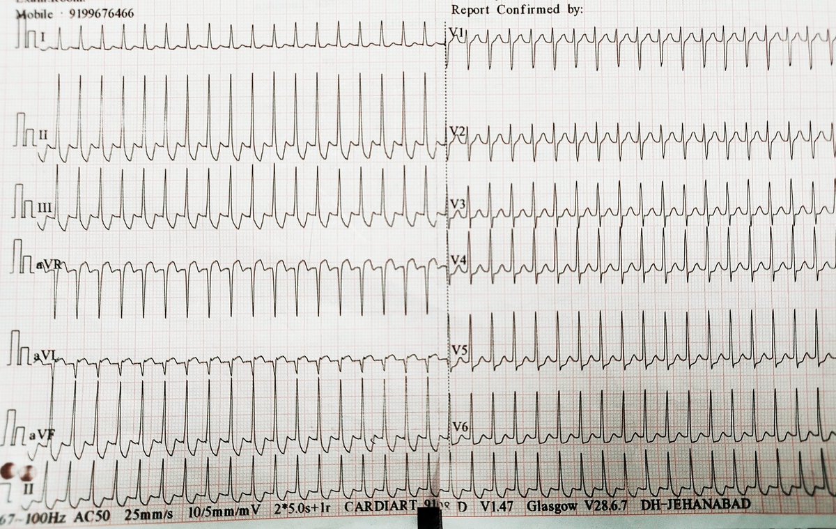 Nihar Ranjan Nayak tweet media