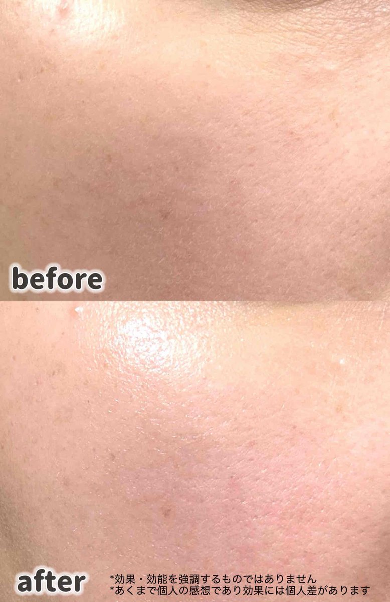puchicosmetics's tweet photo. SKIN&LAB様よりレチノールリペアセラムをご提供いただきました🩶
高濃度なのに低刺激 (レチノール 3%)なヴィーガンリポソームレチノールで毎日のケアに取り入れやすい✨
▼続く
#PR #スキンアンドラブ #skinlab https://t.co/pVNEcjaGPk