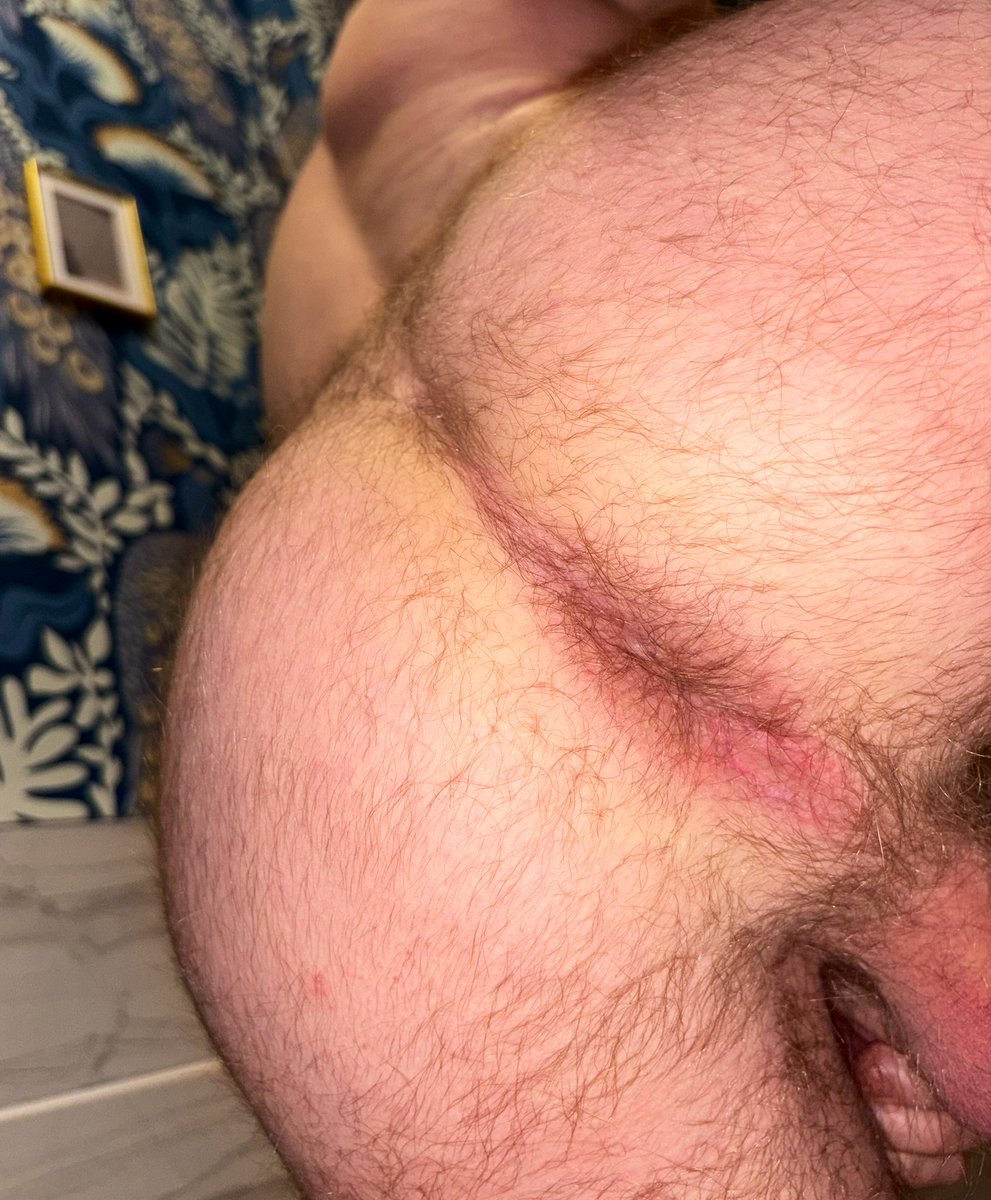 BtmNyc's tweet photo. Airing out my hairy hole https://t.co/edC0CspcI1