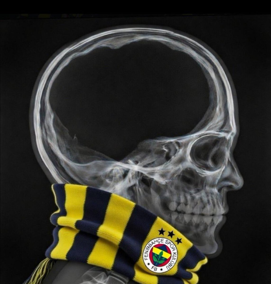 Yasko9999's tweet photo. @ozzy1303 @S_HazinogLu @ultrAslankalesi @osimen_pres @TFF_Org Bunlara cevap vermeyin kendinizi yormayın arkadaşlar bunlara inanan kitle var maalesef büyük sıkıntı Allah şifa versin https://t.co/mcO5fFgN7Q