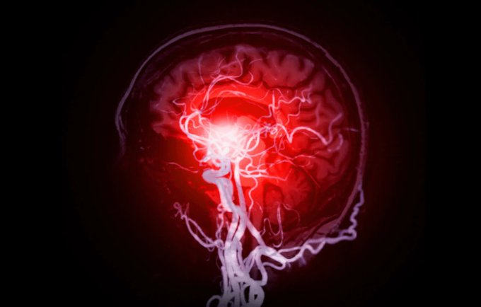 Este es el Dr. Daniel Amen.  

Ha escaneado más cerebros que cualquier otro médico vivo: más de 225.000.  

Su conclusión: la mayoría de las personas destruyen su cerebro sin saberlo todos los días.  

Aquí están las 11 causas silenciosas (y cómo revertirlas):