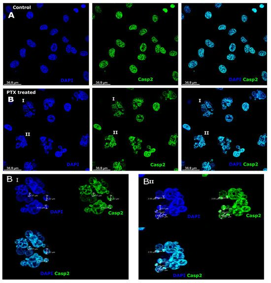 Biomed_MDPI's tweet image. 🔍 SPECIAL INTEREST | A compelling read for focused research areas 
📌 Title: Morphological and Immunocytochemical Characterization of Paclitaxel-Induced Microcells in Sk-Mel-28 Melanoma Cells 
🔗 Link: mdpi.com/2227-9059/12/7… 
#SpecialInterest #DeepDive