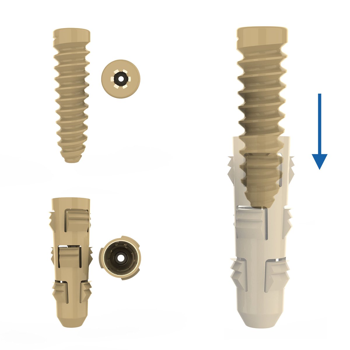 LtdCanwell's tweet photo. CANWELL PEEK Interference Screw 🔩
ACL/PCL reconstruction • arthroscopy fixation • tibial fixation • cannulated • non-absorbable
DM for sizes &amp; catalog 📩 https://t.co/qaIeyxvt3j