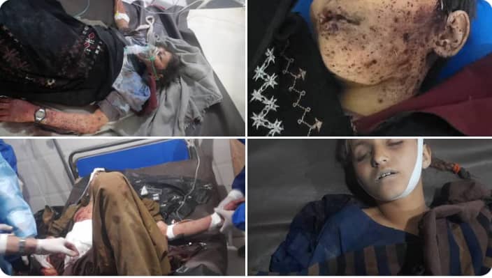 By targeting men, women, and children, the regime is reenacting the crimes of its master, replicating the same brutal and bloody actions once carried out by the Israeli Zionist regime against Palestinian migrant camps.
#ردالظلم