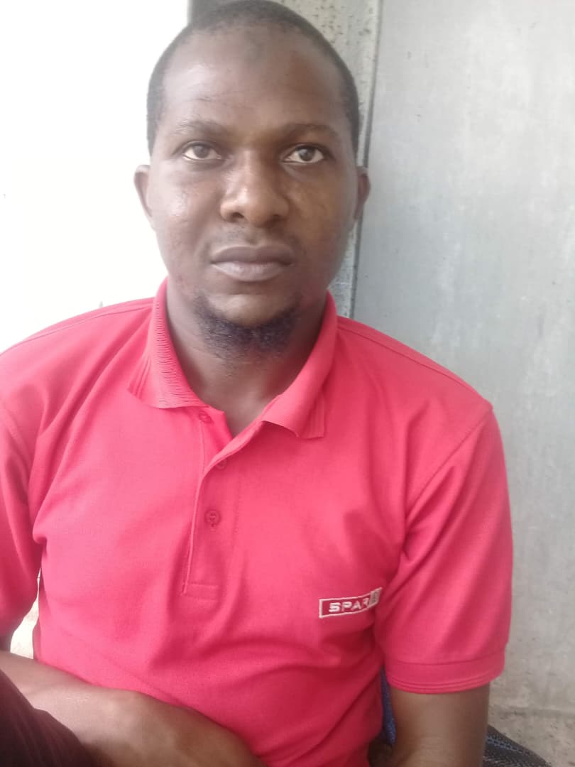 HunkuOladele's tweet photo. Urgent Lifesaving Appeal: Help Save My Brother, Ahmad Rasheed, from Aggressive Facial Cancer

Dear Nigerians, 
I am writing to you today completely heartbroken, but desperate to save my brother’s life. My brother, Ahmad Rasheed Iyanda, is fighting a horrific and aggressive battle against a rapidly growing facial cancer, and we urgently need your help.

If you look at his before and after pictures, you can see the devastating toll this disease has taken on him. What is even more terrifying is how innocently this nightmare began. It started over two years ago with something as simple as a sharp toothache after eating a peanut. We thought it was a minor dental issue. A small, pea-sized swelling appeared, but instead of going away, it began to grow at an alarming rate.

After enduring countless tests, biopsies, and scans at multiple hospitals, including the Lagos University Teaching Hospital (LUTH), we received his diagnosis: Adenoid Cystic Carcinoma of the Maxillary Antrum—a severe and aggressive form of sinus cancer.
Despite our family's best efforts to get him care over the last couple of years, the tumor has grown relentlessly. His most recent CT scans from late 2025 show just how critical his situation has become:

Massive Tumor Growth: The tumor has grown to nearly 10 centimeters in size on the right side of his face.

Bone Destruction: The mass is so aggressive that it has eroded and destroyed the bones of his upper jaw, his cheekbone, and the walls of his right eye socket.

Vision and Breathing Impact: The tumor is physically displacing his right eye outward (proptosis) and has grown into his nasal cavity, severely narrowing his airway and making it difficult to breathe.

Critical Emergency: The most terrifying finding from his latest scan is that the cancer has destroyed his frontal bone and is showing early extension into his brain.

Ahmad is in unimaginable pain, and time is no longer on our side. The cancer is literally inches away from causing irreversible brain damage or worse.

He desperately needs extensive, complex surgery to remove this massive tumor, followed by rigorous cancer treatments. The financial weight of these procedures, continuous scans, and specialized care has completely overwhelmed our family. We have exhausted our resources trying to keep him alive up to this point.

He cannot fight this alone, and we cannot save him without your help.

We are humbly begging for your assistance. Every single Naira and every share matters. Your donation will go directly toward the immediate, life-saving surgery he needs to stop this cancer from advancing further into his brain.

Please help us with donations

Iyanda Ahmad
0017461696
Jaiz Bank 

Please, share and repost this  on your pages, in your groups, and with your friends. The more people who see this, the better his chances.

Please don't forget to keep Ahmad Rasheed in your thoughts and prayers. He is fighting with everything he has, and your spiritual support gives us hope.

For inquiries and more clarity on his case, reach him here (08054839066) (08033652195)

My number too (07034331253)