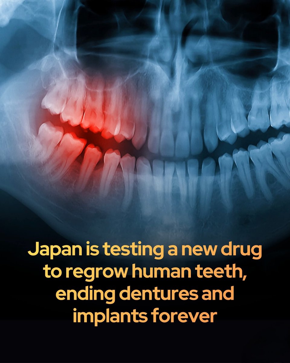 Human trials are underway for a drug that regrows human teeth in just 4 days.

Scientists are initiating human trials for a groundbreaking drug designed to regrow teeth naturally, potentially rendering dentures and implants obsolete.

For decades, permanent tooth loss has been