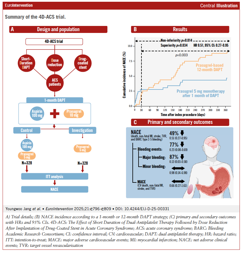 EuroInterventio's tweet photo. After ACS with a drug-coated stent, 1-month DAPT followed by reduced-dose prasugrel monotherapy improved net clinical outcomes — mainly by lowering bleeding without compromising ischaemic safety: the 4D-ACS randomised trial #EIJBestOf  #ACS #PCI 

https://t.co/jb89e1HK8v https://t.co/LwNctosVMq