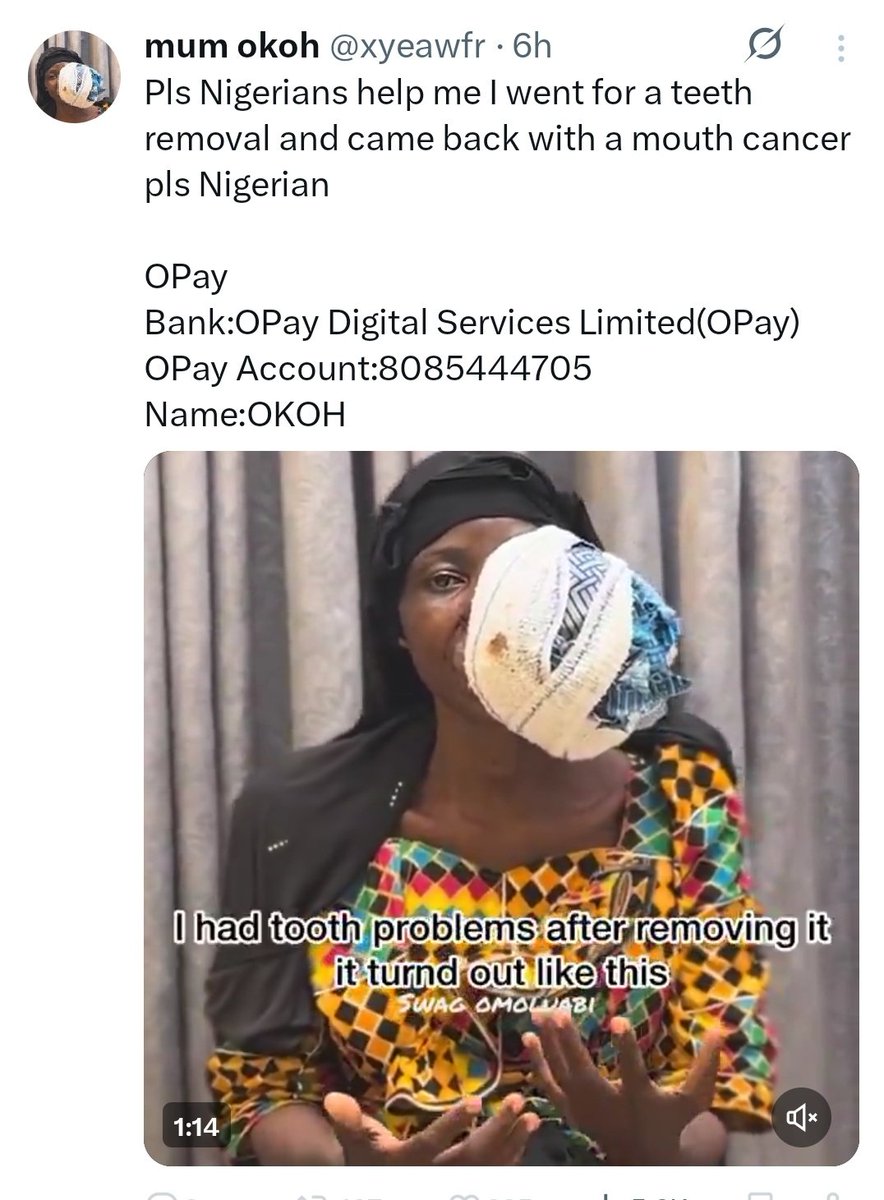 Another scammer is on the rampage. 
Take Note.

Remember the Lung Cancer Guy that deactivated with Millions of Naira.
He is back again with another scam

He is promoting a fraud again for mouth cancer and the account is <a href="/xyeawfr/">mum okoh</a>

Here is how we caught him again