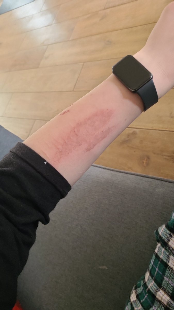 g0e1an's tweet photo. Might start doing this more its kinda cute #shtwt #scratching https://t.co/CtXT1x4TxR