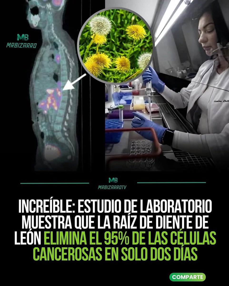 🚨 INSÓLITO: el diente de león podría eliminar hasta el 95 % de células cancerosas en solo dos días

Un grupo de investigadores del University of Windsor, Canadá, descubrió que un extracto acuoso de raíz de diente de león (Taraxacum spp.) logró inducir la muerte programada