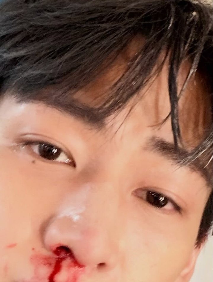 mootyBB's tweet photo. เอ้าาาาา น้อนเป็นอะไรหนิ🥺 https://t.co/uTEmtUkGX3