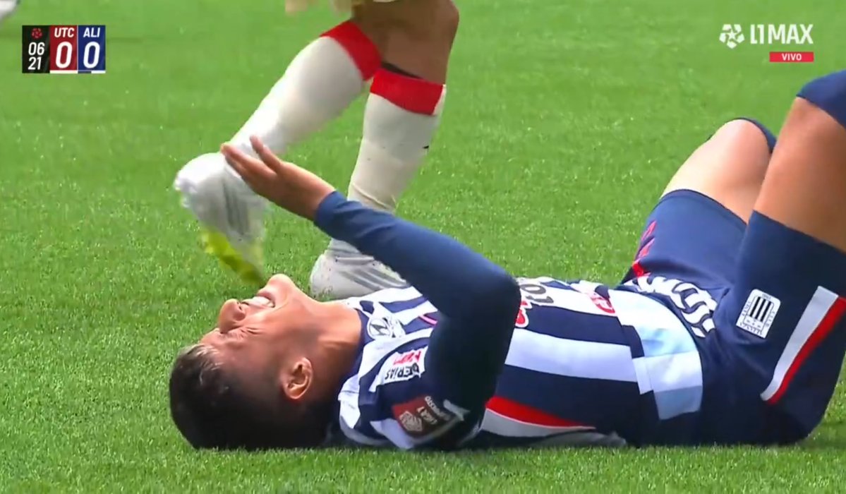 😳🟥💥 BRUTAL PATADA de LUIS ARCE contra el rostro de MARCO HUAMÁN, de Alianza Lima. Tarjeta roja para el jugador de UTC.