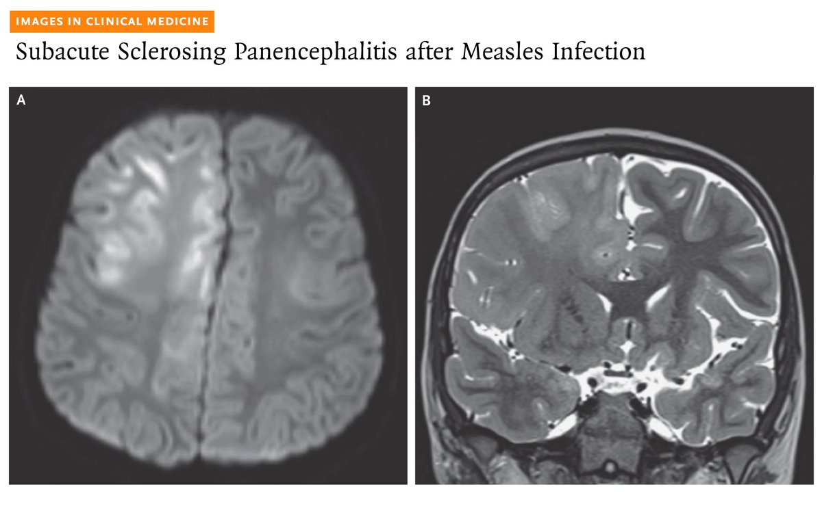 NEJM tweet media