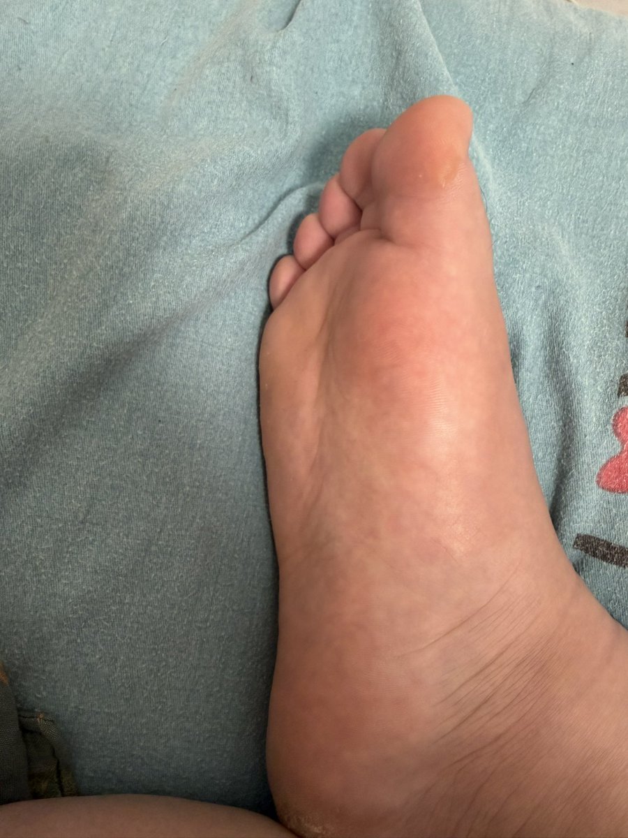 踩在脚下 tweet media