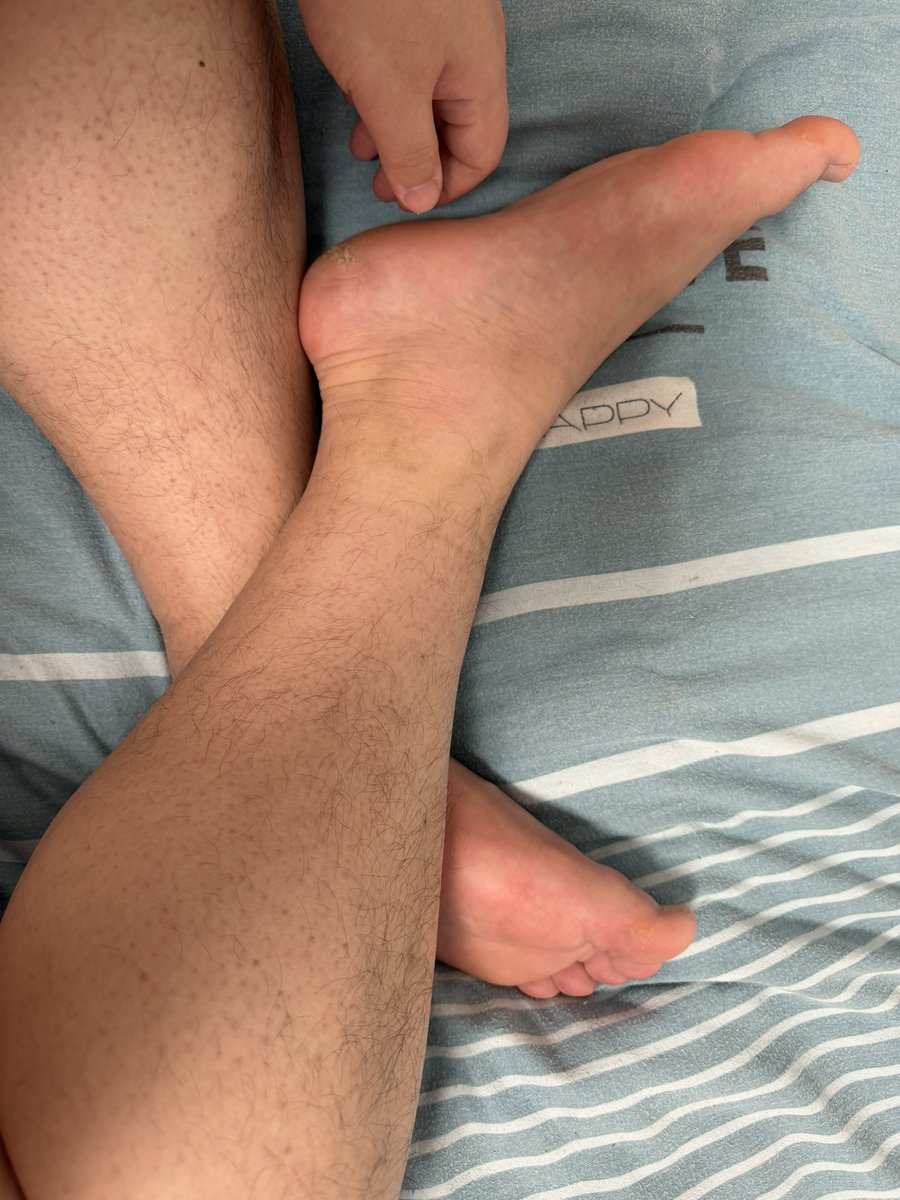 踩在脚下 tweet media