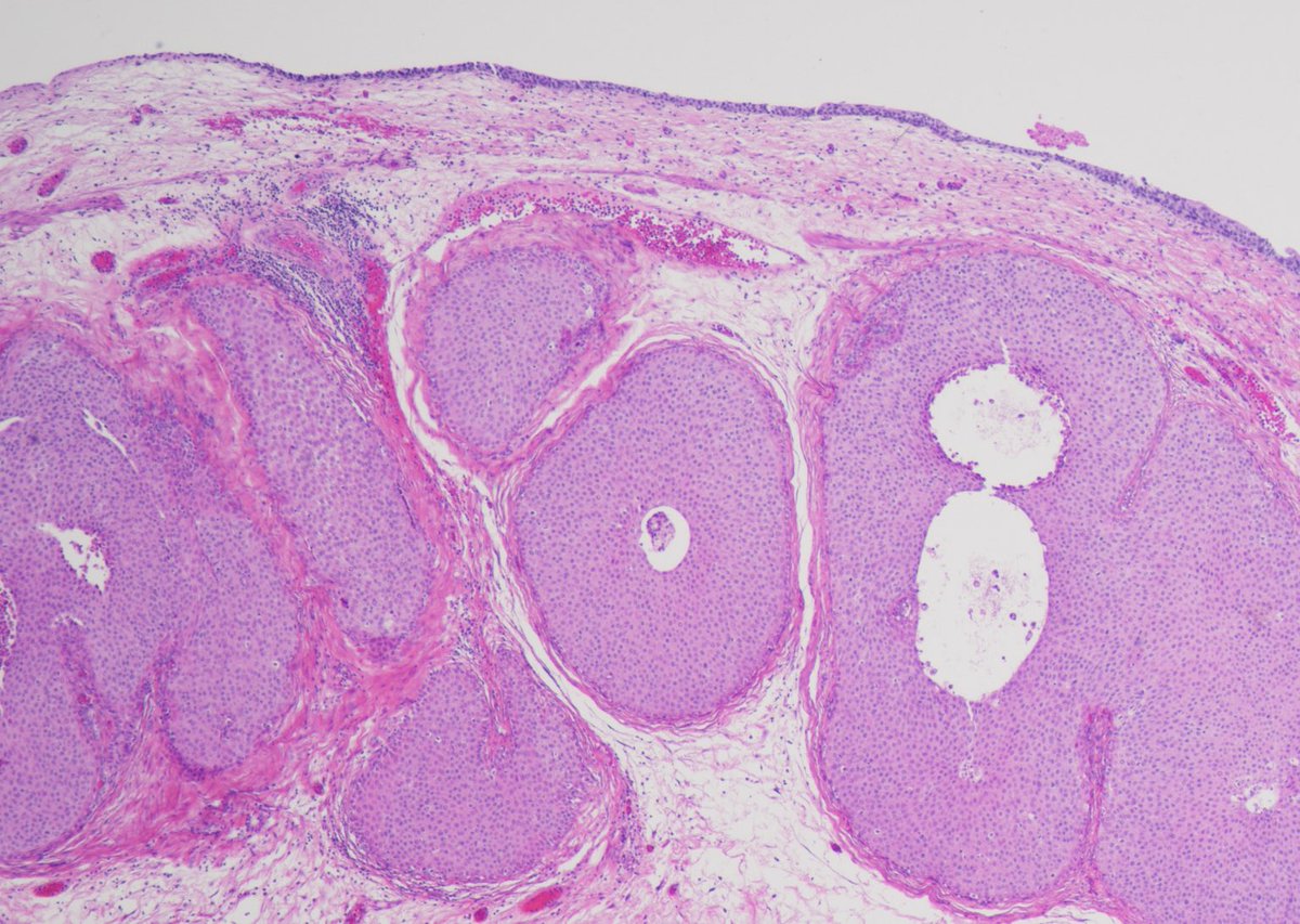 Andres Matoso tweet media