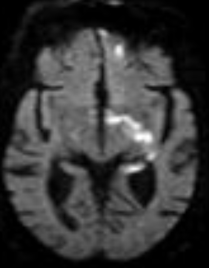 Whitfield Lewis, MD 🇦🇬🇺🇸 tweet media