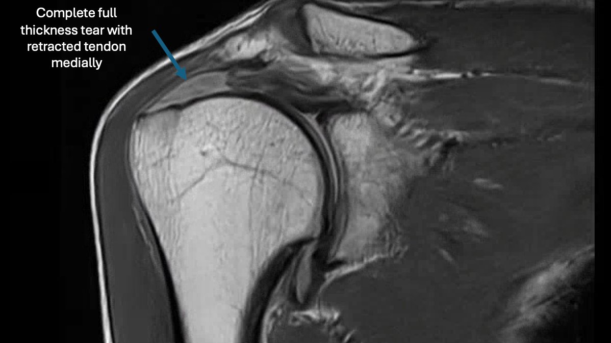 Rheumatology US Case-based Learning tweet media