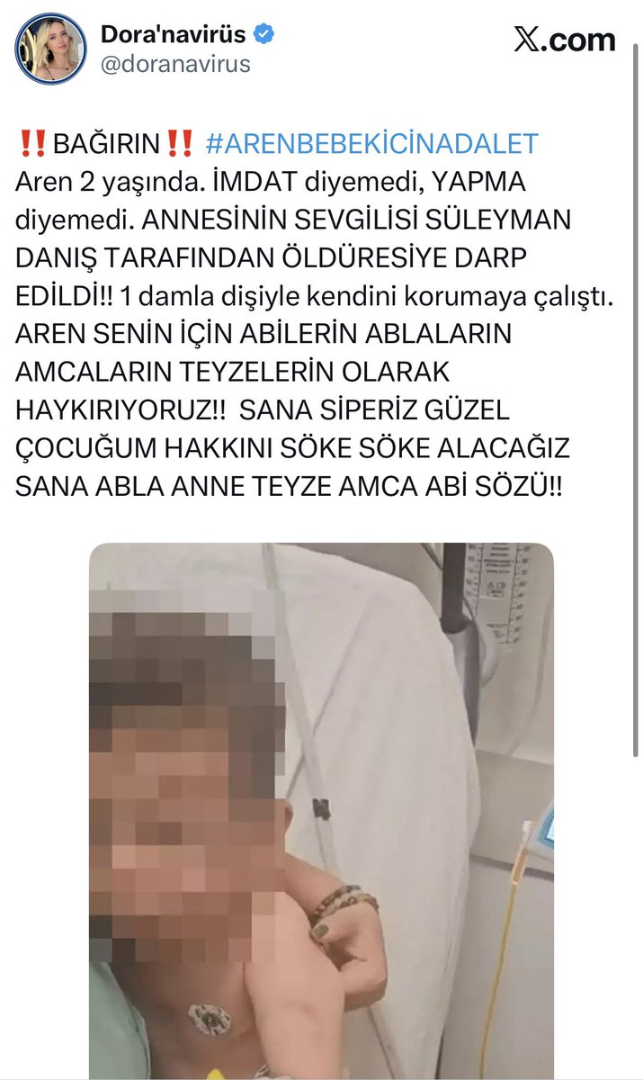 doranavirus's tweet photo. Annesinin sevgilisinden şiddet gören ve dişi kırılan Aren bebeğimizi hatırladınız mı? BEN MASUMUM diyen annecik de hapis aldı🤝�� Hepinizden Allah razı olsun Aren bebeğe ses oldunuz🙏🏻🙏🏻 https://t.co/NXGKaH7Ags