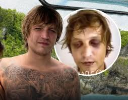 Pembunuhan Sadis!...

Igor Komarov adalah pria Ukraina berusia 28 tahun yang menjadi korban penculikan brutal di Bali sekitar pertengahan Februari 2026.

Dia dilaporkan sebagai anak dari Oleksandr "Narik" Petrovsky, seorang figur yang dikaitkan dengan dunia kejahatan terorganisir