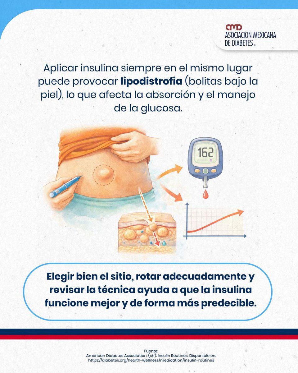 💉 ¿Sabías que el lugar donde te aplicas la insulina puede cambiar cómo actúa en tu cuerpo?

No todas las zonas absorben igual, y aplicar siempre en el mismo sitio puede afectar la absorción .

Rotar, revisar tu técnica y elegir bien la zona también es parte de un tratamiento 💙